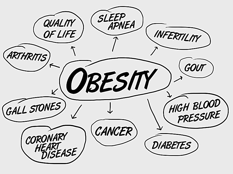 obesity feature